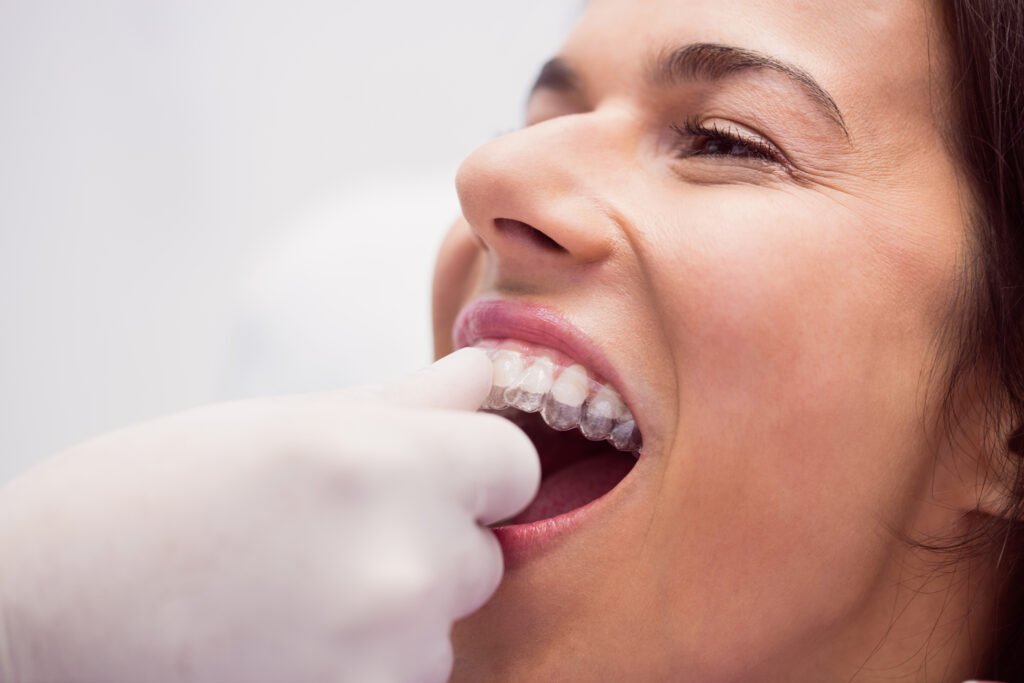 Dentist Assisting A Patient With Fitting Dental Braces