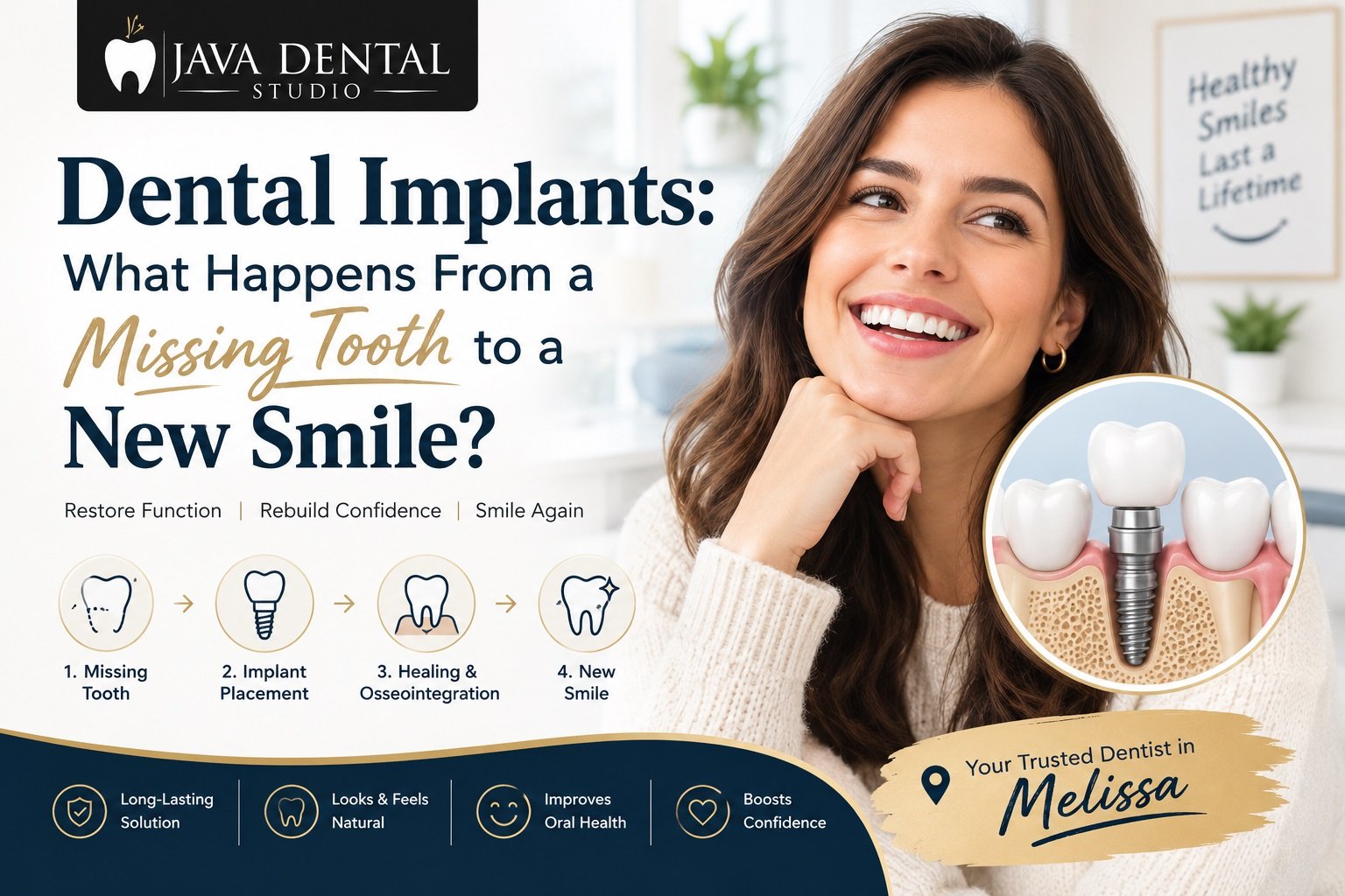 Dental Implant in Melissa